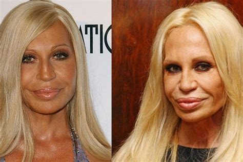 donatella versace cirugias plasticas|La Transformación de Donatella Versace: Antes y Después de su .